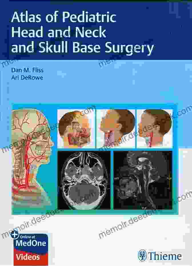 An Atlas For Skull Base Surgeons Surgical Anatomy Of The Internal Carotid Artery: An Atlas For Skull Base Surgeons